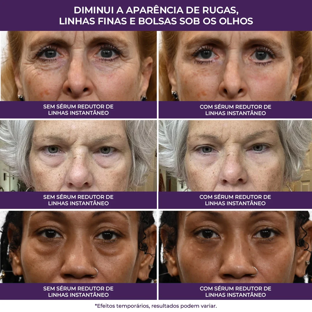 Imagem do produto 6